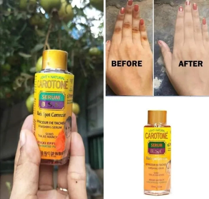 Carotone Serum - 30ml